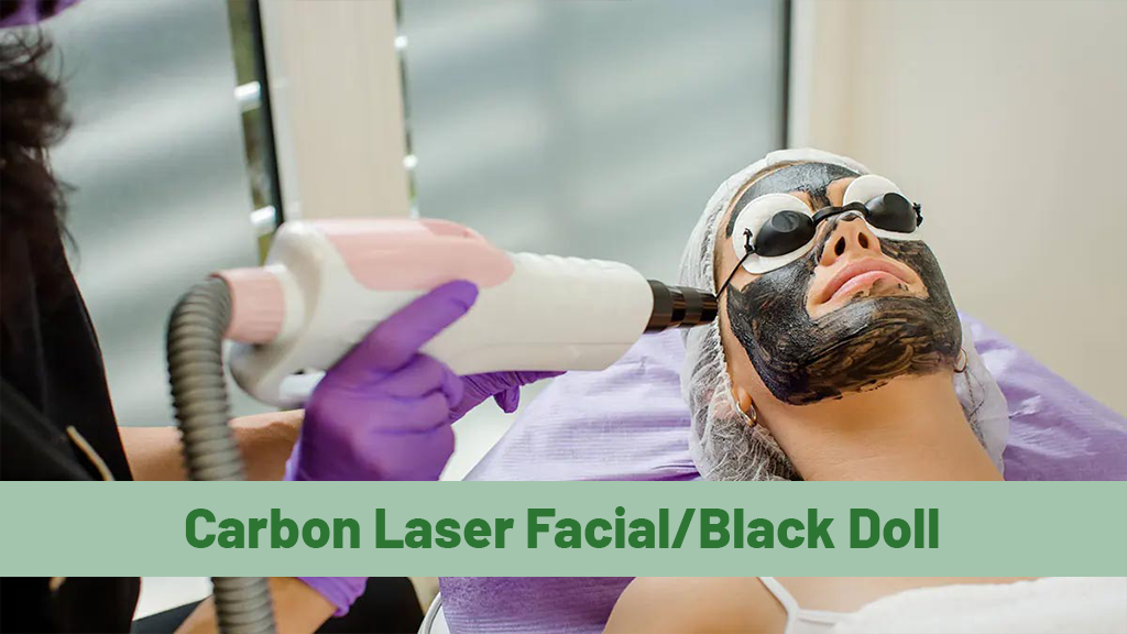 Carbon Laser Facial Black Doll Treatment