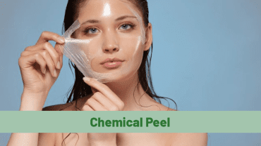 Chemical Peel Facial