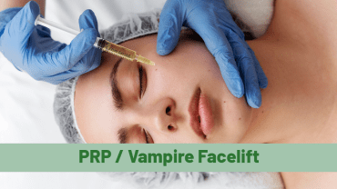 PRP / Vampire Facelift